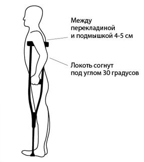 Изображение как правильно подобрать подмышечные костыли