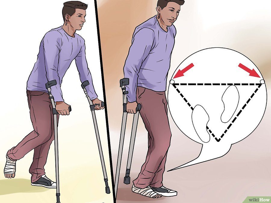 Как ходить на подлокотных костылях